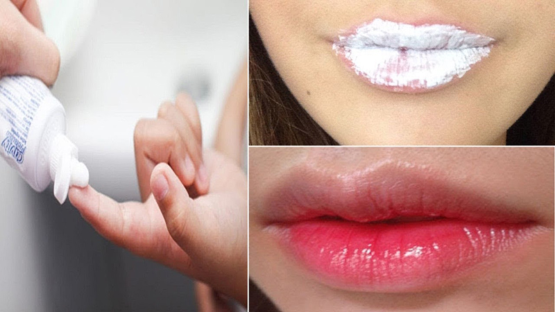 Bạn có thể làm mỏng môi với kem đánh răng