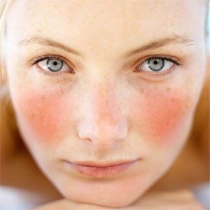rửa mặt tránh được các bệnh về da