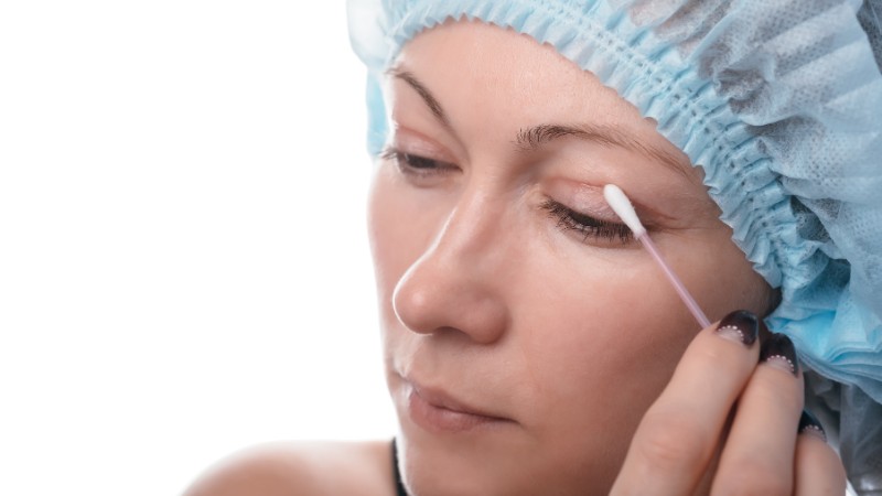 Vệ sinh mí mắt đúng cách sẽ giúp quá trình hồi phục vết thương diễn ra nhanh hơn