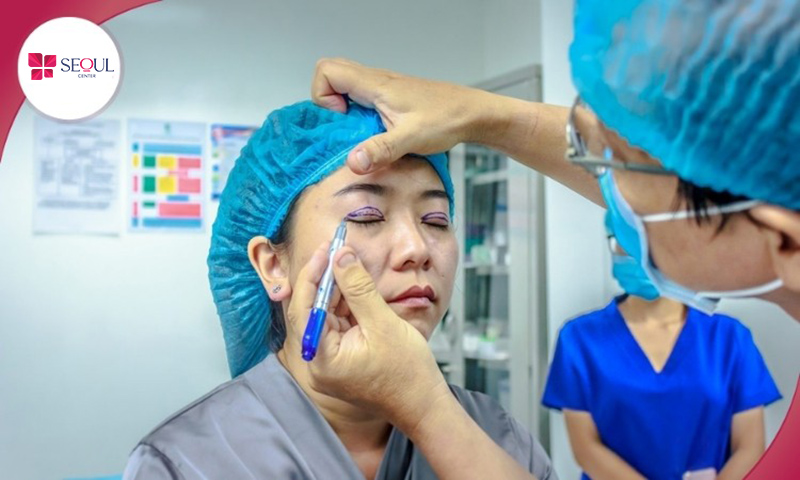 Bác sĩ xem xét căn chỉnh tỉ lệ cắt mí dựa trên tổng thể khuôn mặt khách hàng