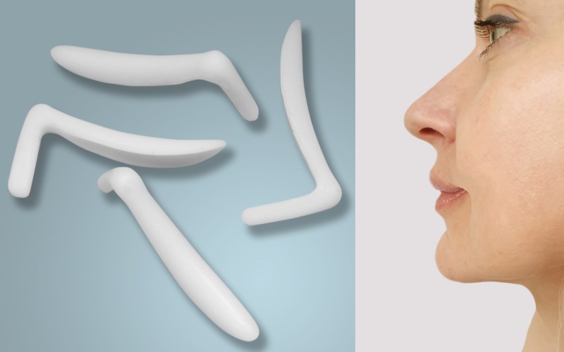 Phương pháp nâng mũi bằng sụn nhân tạo có chi phí hợp lý