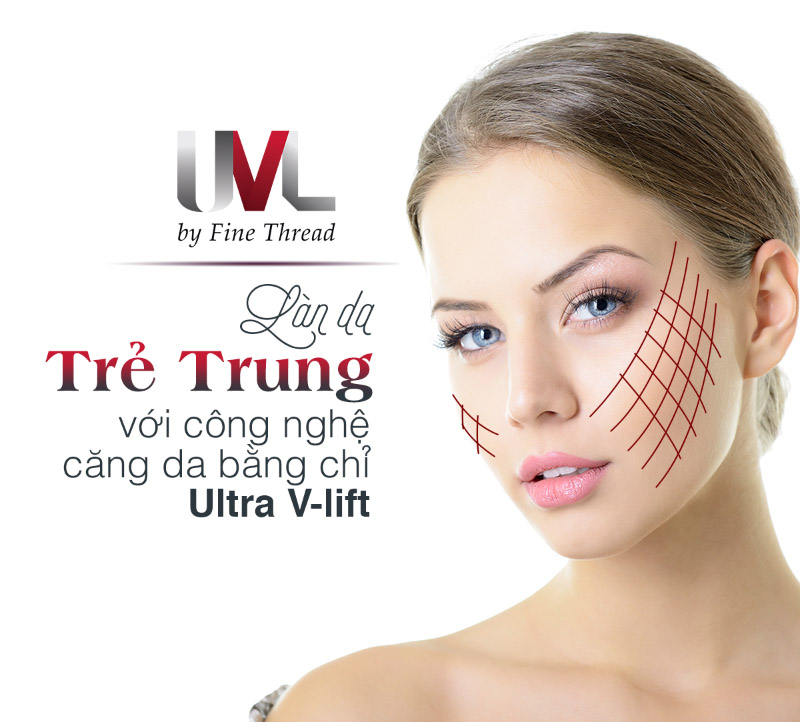 Căng da mặt bằng chỉ Ultra V Lift rất an toàn và không gây biến chứng