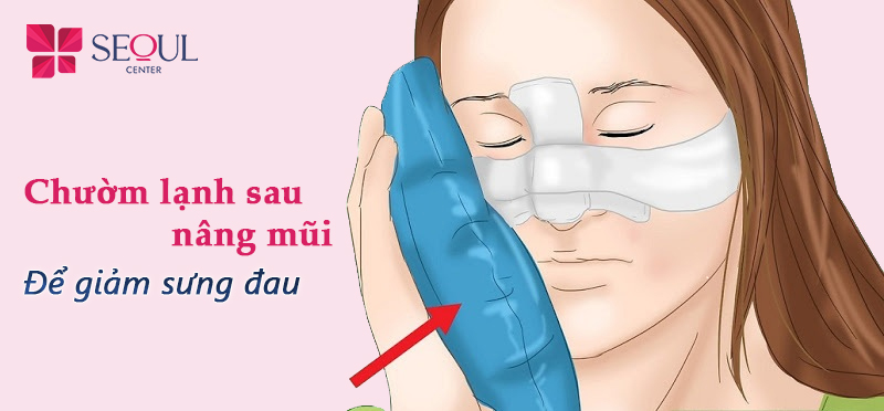 Cần thực hiện chườm lạnh sau khi nâng mũi thường xuyên trong vòng 48 giờ để giảm sưng đau