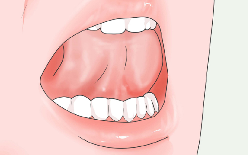 Khi tập mewing cần chú ý tránh tác động lực mạnh lên hai hàm răng
