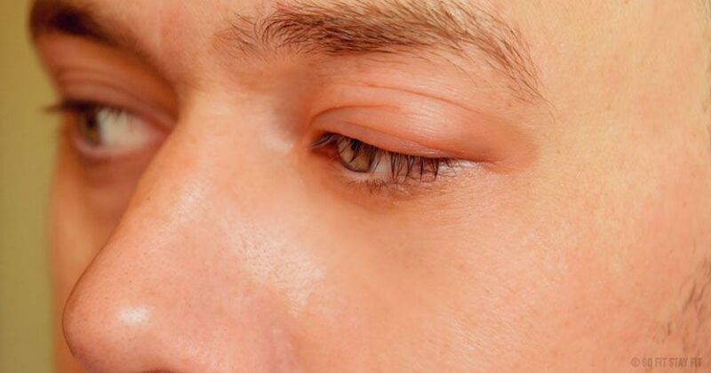 Sử dụng quá nhiều chất kích thích sẽ gây ảnh hưởng mí mắt làm mắt khô 