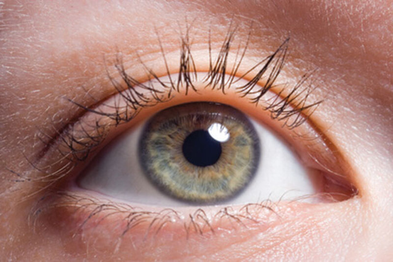Mắt bị sưng gây ảnh hưởng nhiều đến tầm nhìn và thị giác sẽ suy yếu