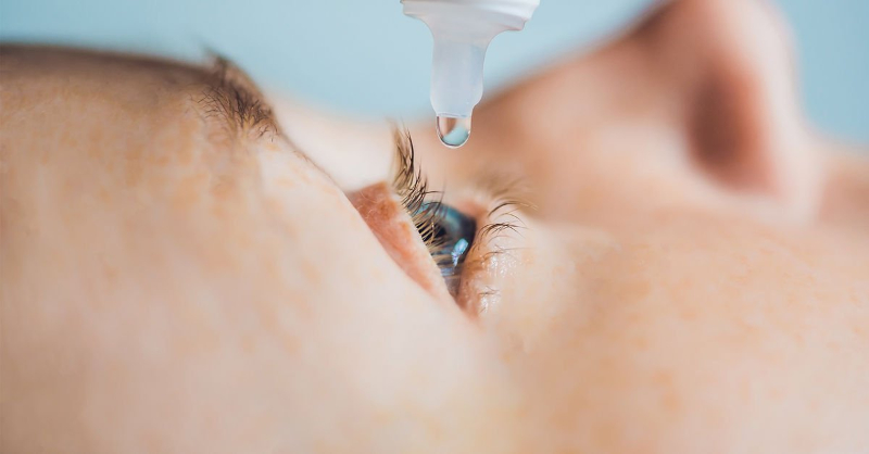 Điều trị viêm kết mạc ở trẻ do virus bằng thuốc kháng sinh dạng thuốc nhỏ mắt