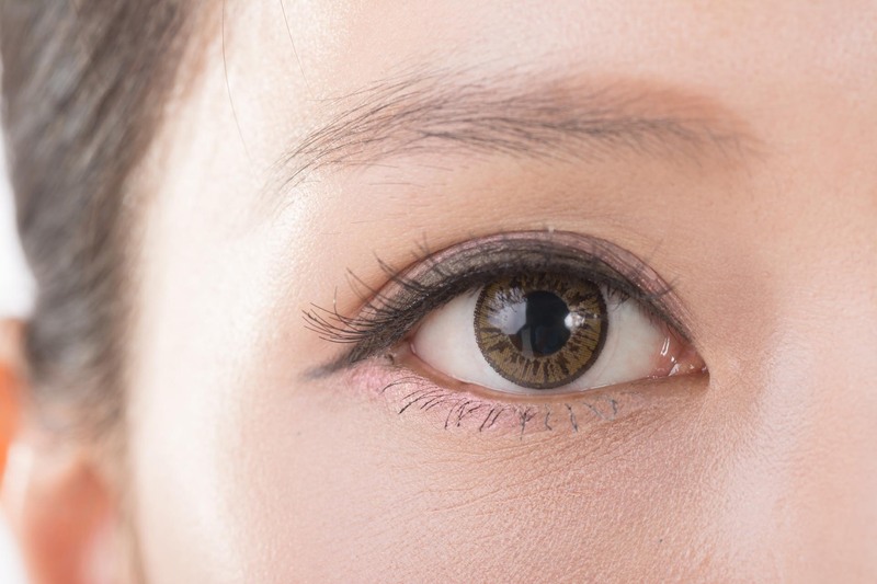 Mắt 2 mí được duy trì kết quả lâu dài, ít gặp biến chứng
