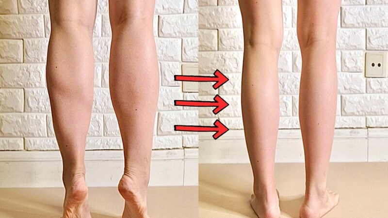 Đôi chân thon gọn, vóc dáng cân đối sau khi tiến hành hút mỡ bắp chân