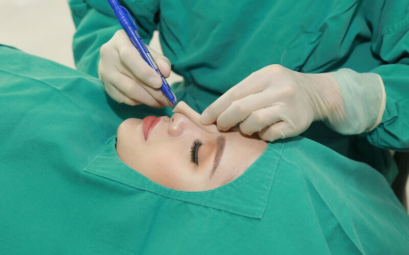 Phẫu thuật nâng mũi được chỉ định cho những ai có dáng mũi thấp tẹt