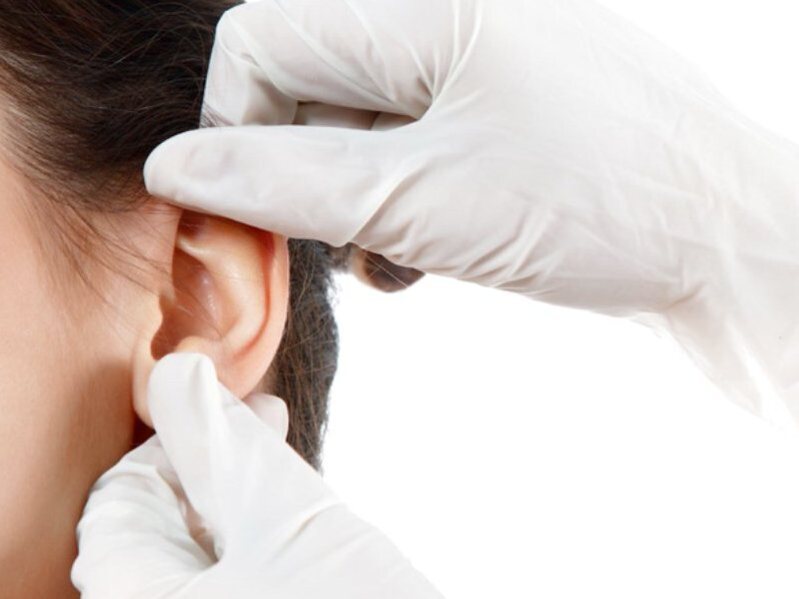 Vách ngăn yếu làm đôi tai của bạn bị lệch khỏi vị trí ban đầu
