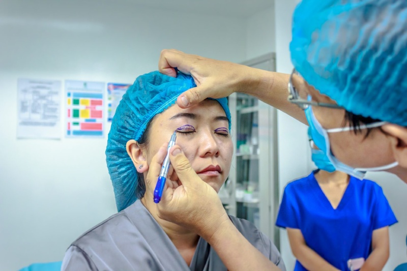 Bác sĩ Nguyễn Kim Khoa chuyên thực hiện nhấn mí mắt đẹp và an toàn tại TpHCM