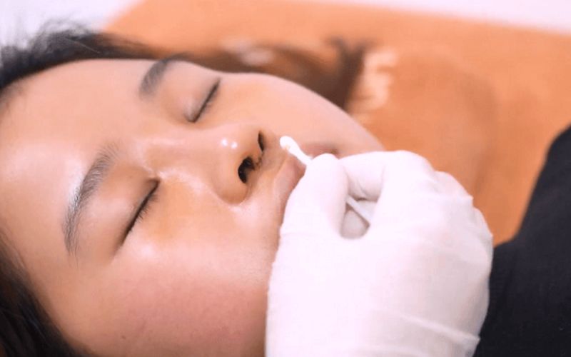 Vệ sinh mũi sạch sẽ, phòng ngừa viêm nhiễm để mũi nhanh lành hơn