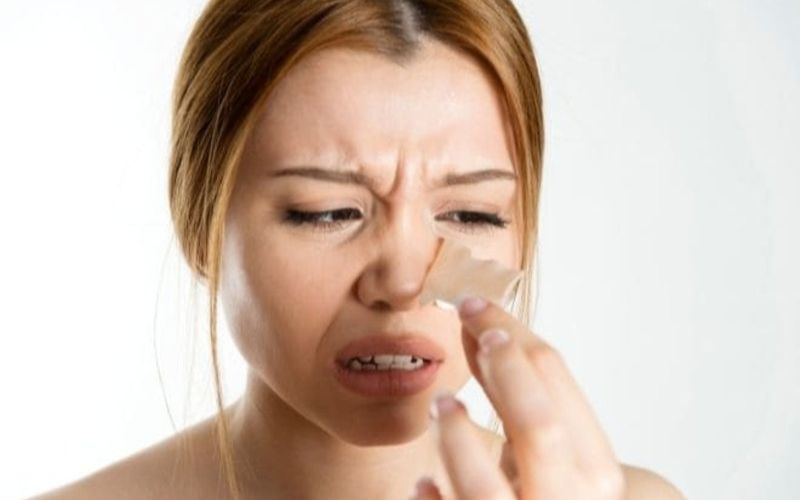 Chăm sóc vết thương nâng mũi đúng cách sẽ giúp mũi nhanh lành
