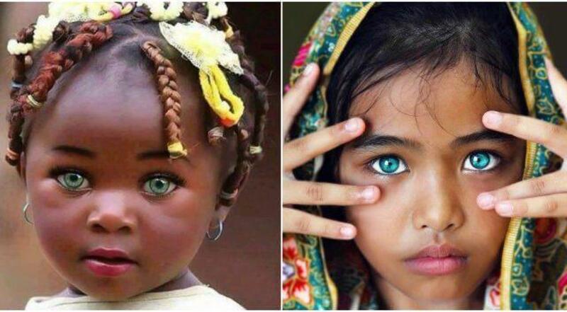 Màu sắc của mắt do sắc tố melanin quyết định
