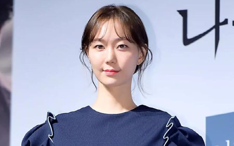 Lee Yoo Young là nữ diễn viên sở hữu nhan sắc xinh đẹp cùng với đôi mắt khác biệt