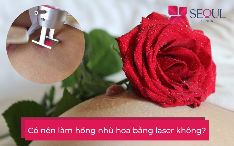 Có nên làm hồng nhũ hoa bằng laser không?