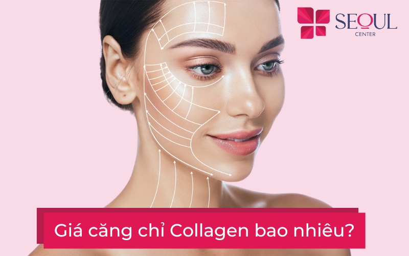 giá căng chỉ collagen