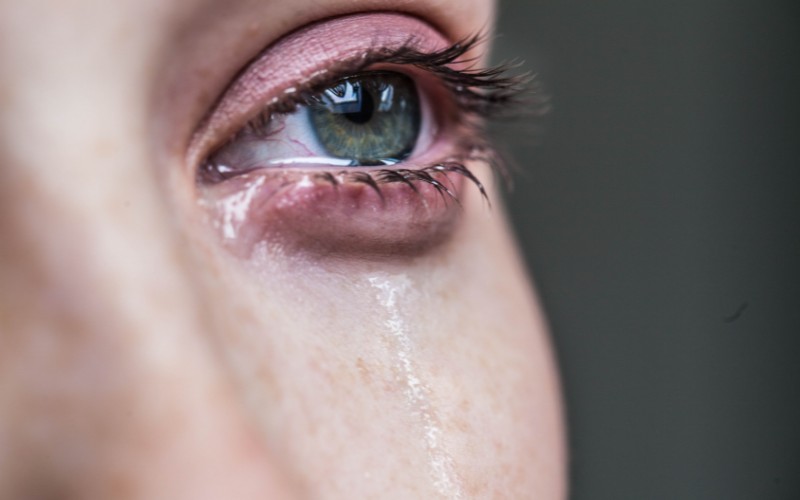 Bị chảy nước mắt là một tình trạng thường gặp của khách hàng sau khi cắt mí