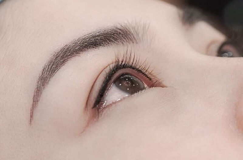 Mí mắt hở là tình trạng khá phổ biến gây ảnh hưởng đến sinh hoạt hàng ngày