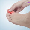 Nguyên nhân và yếu tố nguy cơ của chứng vẹo ngón chân cái