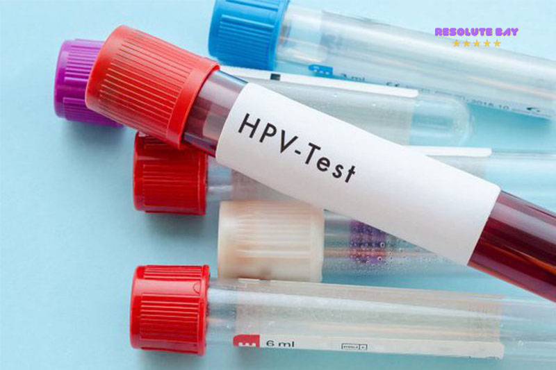 Cách chẩn đoán HPV