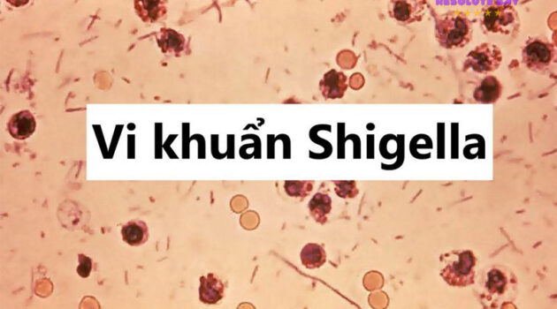 Shigella là gì