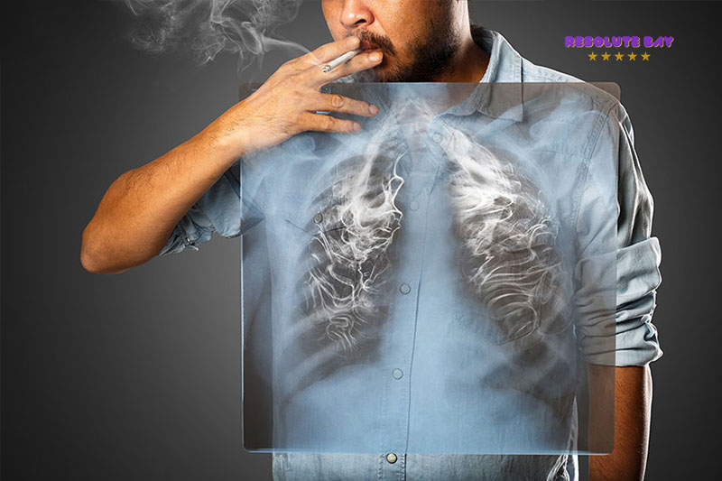 Nguyên nhân và nguy cơ tiềm ẩn của ung thư phổi là gì