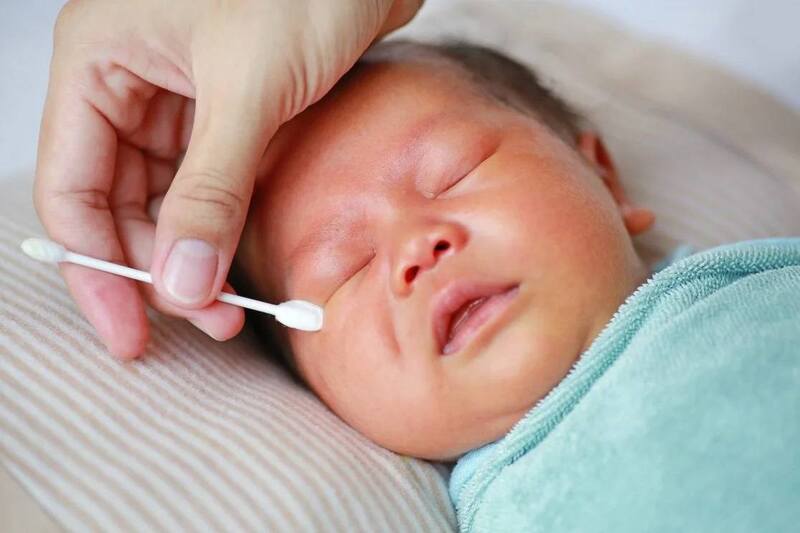 Phẫu thuật mở túi lệ xuống đến tận mũi có thể thực hiện cho các bé sơ sinh
