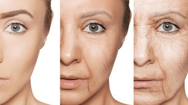 Tốc độ lão hoá nhanh sẽ ảnh hưởng đến tuổi thọ mí mắt