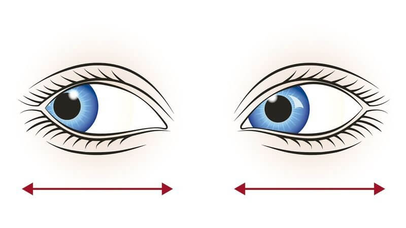 Bài tập nhìn về 2 hướng khác nhau có thể cải thiện tình trạng mắt dại