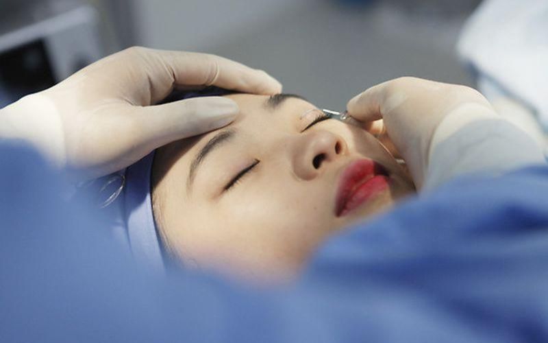 Chi phí cắt mắt sụp mí có phụ thuộc một phần vào tay nghề bác sĩ thực hiện