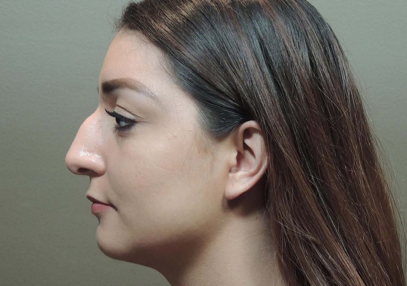 Phụ nữ có đặc điểm mũi diều hâu thường bị xa lánh bởi tính cách thâm độc