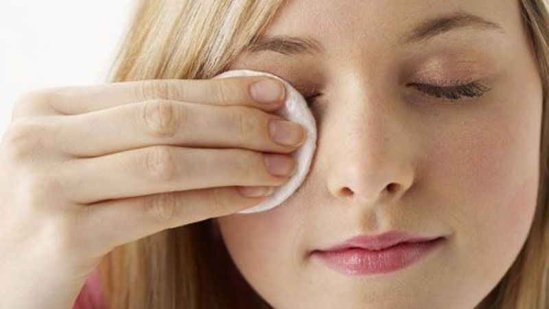 Vệ sinh mí mắt thường xuyên để tránh nhiễm khuẩn