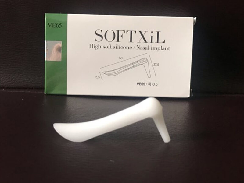 Sụn nâng mũi Softxil được đánh giá cao về độ an toàn, hiệu quả thẩm mỹ