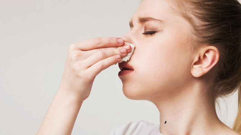 Tình trạng tụ dịch mũi sau nâng là một biến chứng nhỏ xảy ra phổ biến